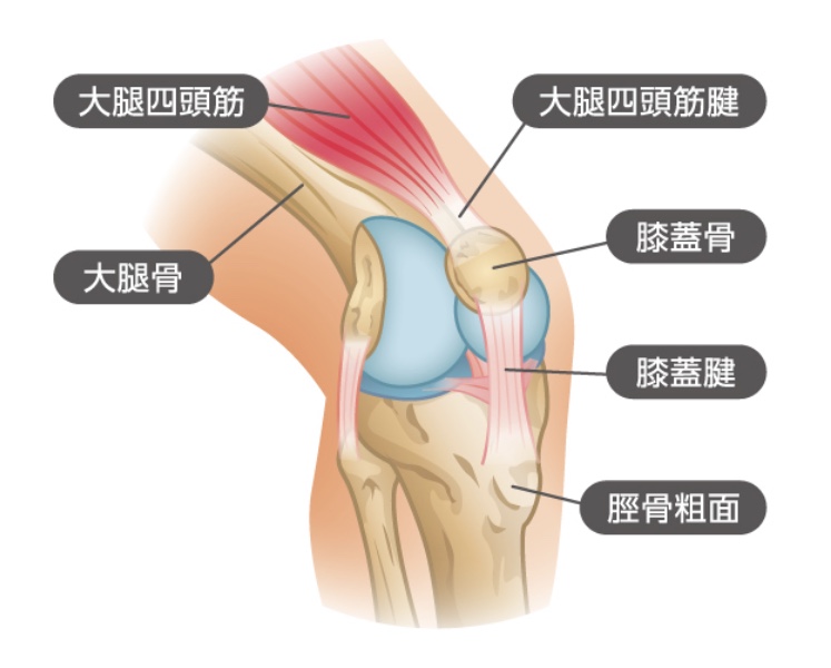 大腿四頭筋腱炎の痛みとその他の症状
